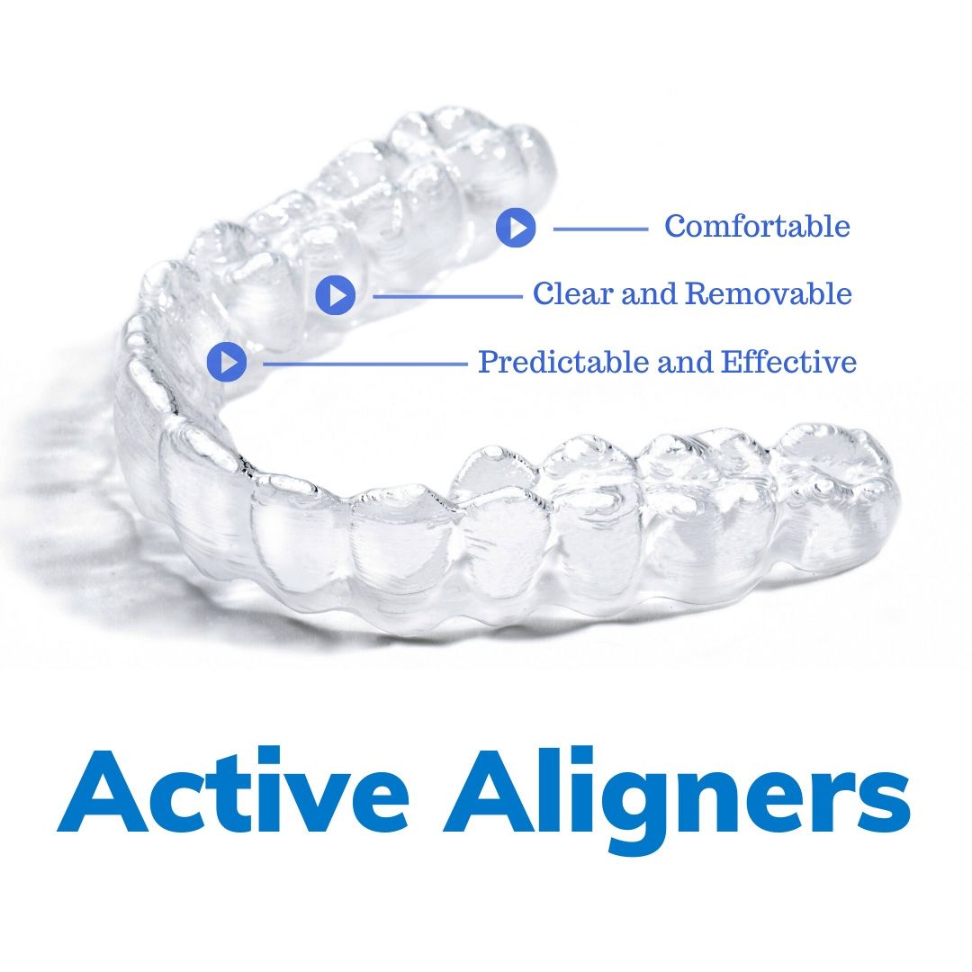 Active Aligners are comfortable, clear, removable, predictable and effective