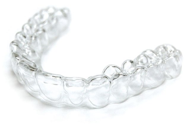 First, what Active Aligners and clear aligners are