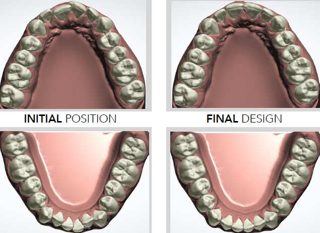 3D imaging and treatment planning