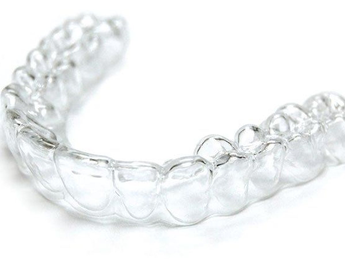 Active Aligners tray held between fingers