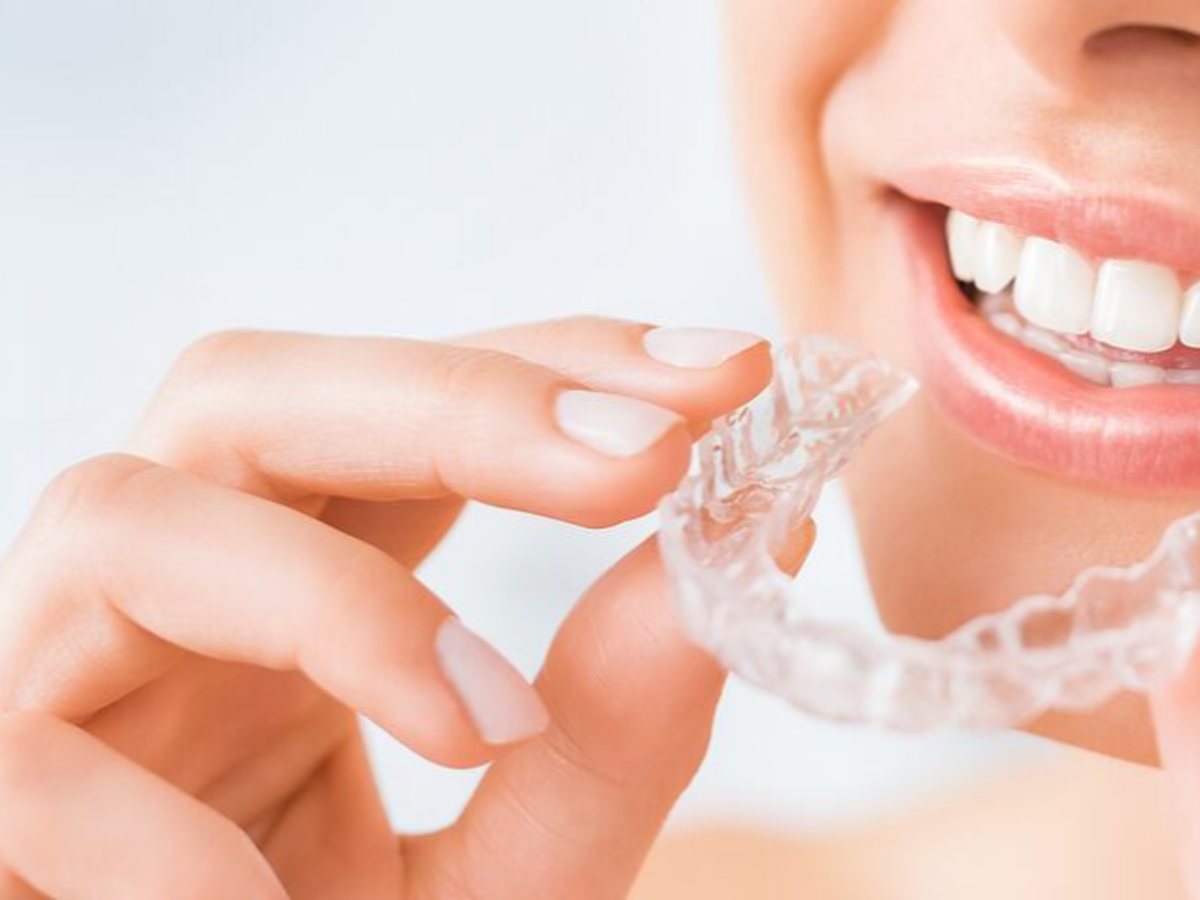 Clear aligners lifestyle