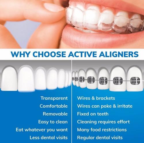 Why choose Active Aligners